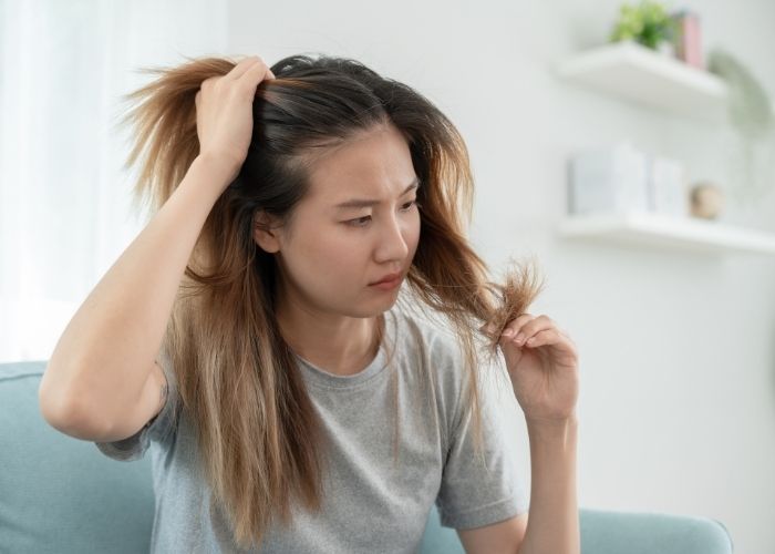 Hair Loss in Women